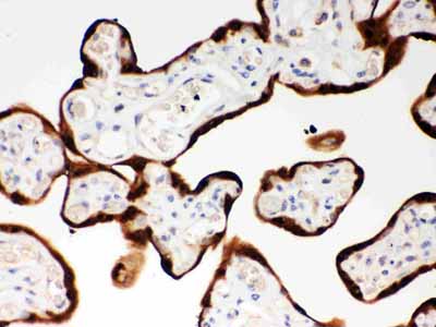 2 - Anti-SerpinB2 Picoband Antibody ABO12046