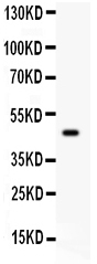 1 - Anti-SerpinB2 Picoband Antibody ABO12046