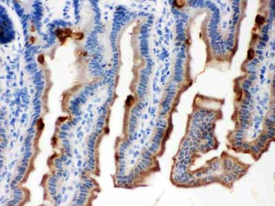 2 - Anti-MASPIN Picoband Antibody ABO12047