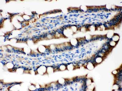 2 - Anti-MASPIN Picoband Antibody ABO12047