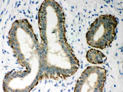 2 - Anti-MASPIN Picoband Antibody ABO12047