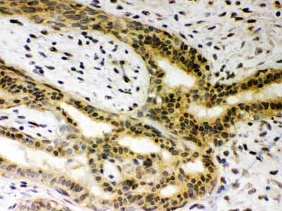 2 - Anti-SIRT6 Picoband Antibody ABO12048