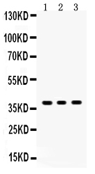 1 - Anti-SIRT6 Picoband Antibody ABO12048