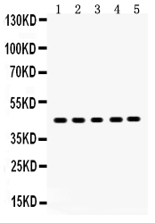 1 - Anti-SIRT7 Picoband Antibody ABO12049