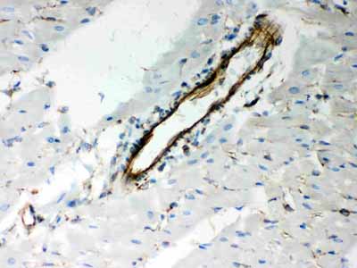 2 - Anti-Vimentin Picoband Antibody ABO12050