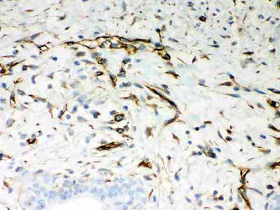 2 - Anti-Vimentin Picoband Antibody ABO12050