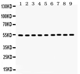 1 - Anti-Vimentin Picoband Antibody ABO12050