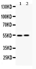 1 - Anti-Vimentin Picoband Antibody ABO12050