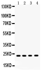 1 - Anti-RBP4 Picoband Antibody ABO12051