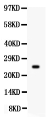 1 - Anti-Prolactin Picoband Antibody ABO12052