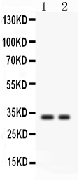 1 - Anti-SFRP2 Picoband Antibody ABO12053