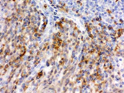 2 - Anti-P-Selectin Antibody ABO12054