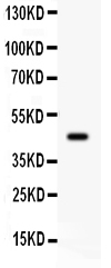 1 - Anti-ADRB2 Picoband Antibody ABO12056