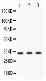 1 - Anti-Cyclin D1 Picoband Antibody ABO12061