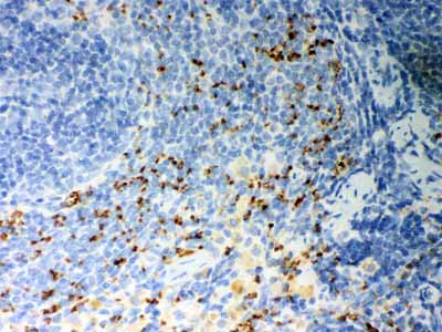 2 - Anti-CD36/SR-B3 Antibody ABO12062