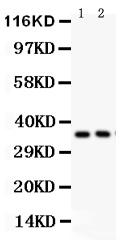 1 - Anti-FRZB Picoband Antibody ABO12063