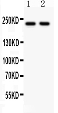 1 - Anti-NMDAR2B Picoband Antibody ABO12064