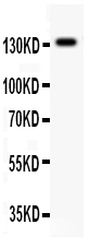 1 - Anti-NMDAR2C Picoband Antibody ABO12065