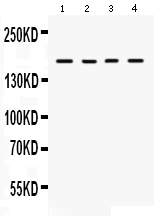 1 - Anti-HKDC1 Picoband Antibody ABO12066