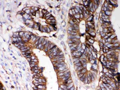 2 - Anti-HLA A Picoband Antibody ABO12067