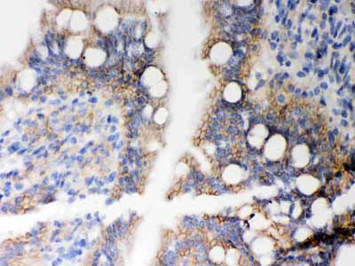 2 - Anti-HLA A Picoband Antibody ABO12067