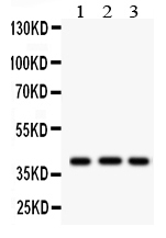 1 - Anti-HLA A Picoband Antibody ABO12067