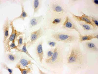 8 - Anti-HLA-C Picoband Antibody ABO12068
