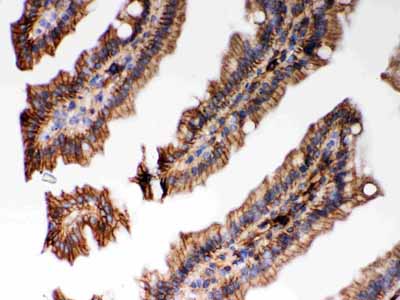 2 - Anti-HLA-C Picoband Antibody ABO12068