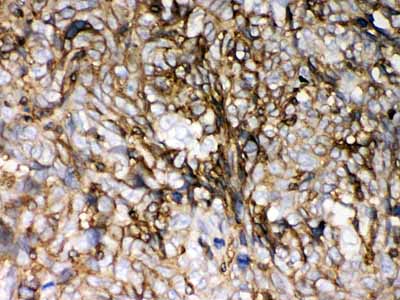 2 - Anti-HLA-C Picoband Antibody ABO12068