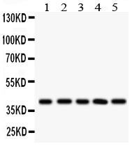 1 - Anti-HLA-C Picoband Antibody ABO12068