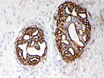 2 - Anti-PKM2 Picoband Antibody ABO12070