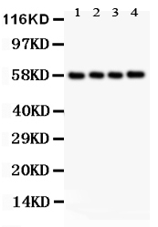 1 - Anti-PKM2 Picoband Antibody ABO12070