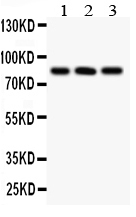 1 - Anti-Calcineurin A Picoband Antibody ABO12073