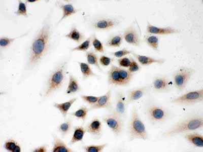 8 - Anti-Peroxiredoxin 4 Picoband Antibody ABO12074