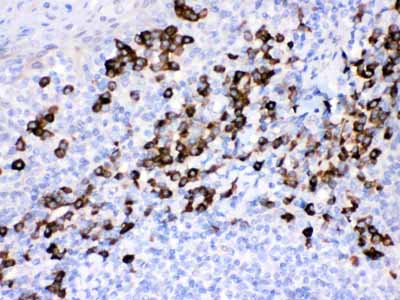 2 - Anti-Peroxiredoxin 4 Picoband Antibody ABO12074