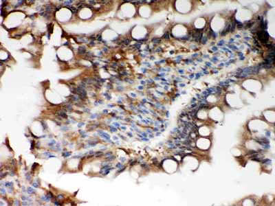 2 - Anti-Peroxiredoxin 5 Picoband Antibody ABO12075