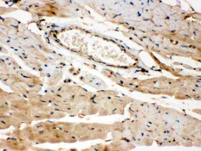 2 - Anti-ROCK2 Picoband Antibody ABO12078