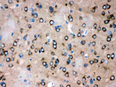 2 - Anti-ROCK2 Picoband Antibody ABO12078