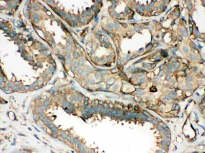 2 - Anti-ROCK2 Picoband Antibody ABO12078