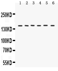 1 - Anti-ROCK2 Picoband Antibody ABO12078