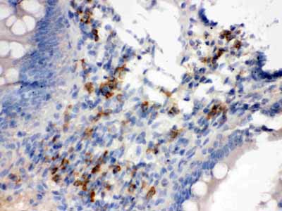 2 - Anti-Syndecan-4/SDC4 Antibody ABO12079
