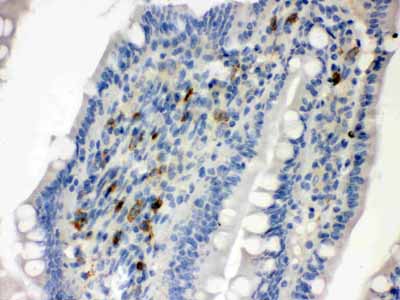 2 - Anti-Syndecan-4/SDC4 Antibody ABO12079