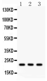 1 - Anti-Syndecan-4/SDC4 Antibody ABO12079