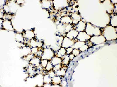 2 - Anti-SFTPA1/2 Picoband Antibody ABO12081