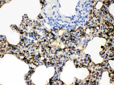 2 - Anti-SFTPA1/2 Picoband Antibody ABO12081
