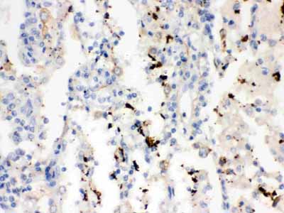 2 - Anti-SFTPA1/2 Picoband Antibody ABO12081