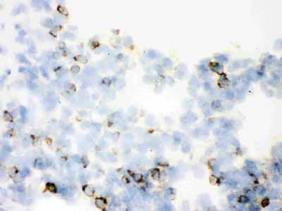 2 - Anti-SFTPA1/2 Picoband Antibody ABO12081