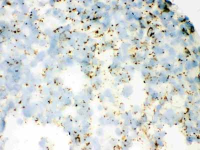 2 - Anti-SFTPA1/2 Picoband Antibody ABO12081
