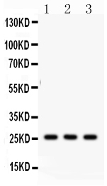 1 - Anti-SFTPA1/2 Picoband Antibody ABO12081