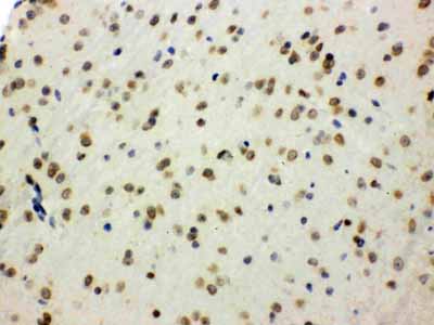 2 - Anti-SHC Picoband Antibody ABO12082